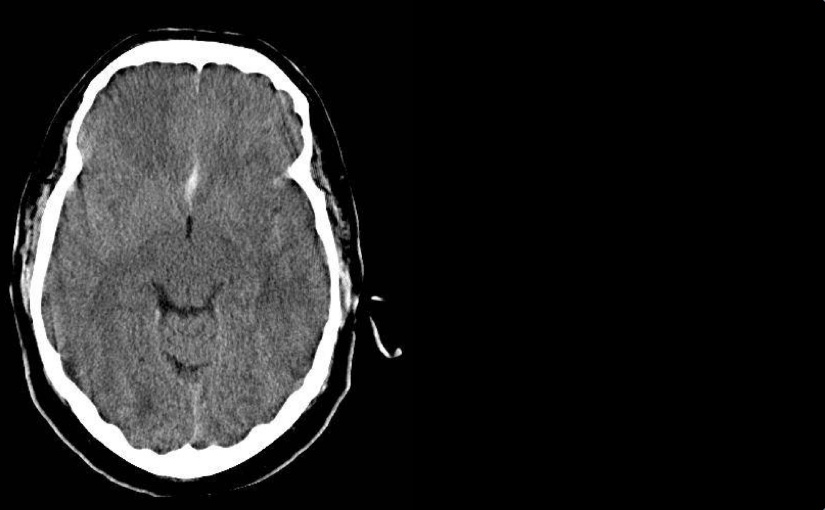 Muss ich ein Bild machen? Über die Notwendigkeit von Bildgebung bei&nbsp;Kopfschmerzen